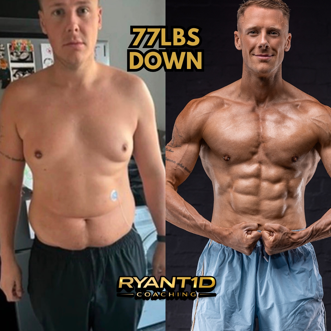 Tom — 77lbs down with RyanT1D Coaching